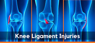 ligament
