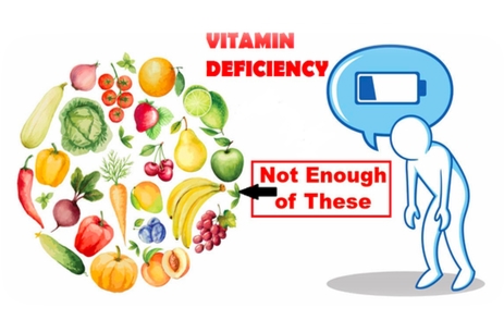 deficient