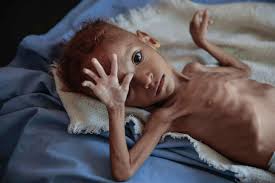 starvation