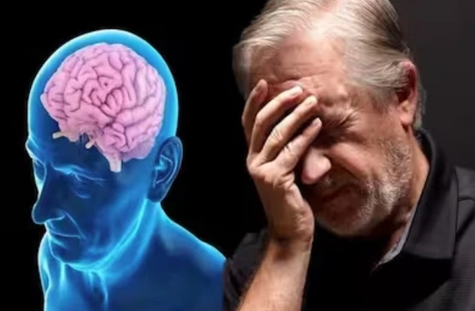 alzheimer