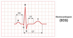 electrocardiogram