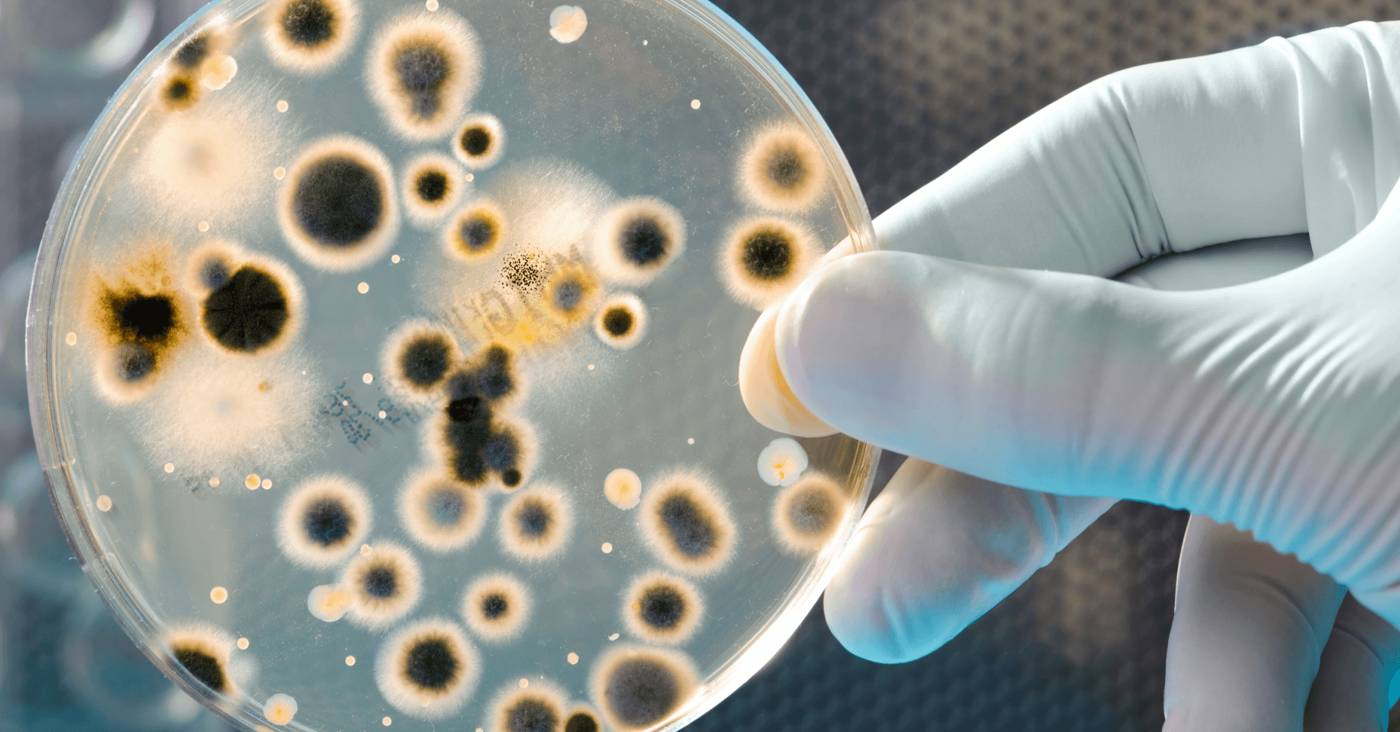microbial