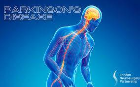 Parkinson's disease