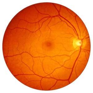 retina