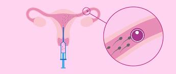 insemination